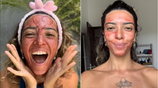 Reprodução/Redes sociais