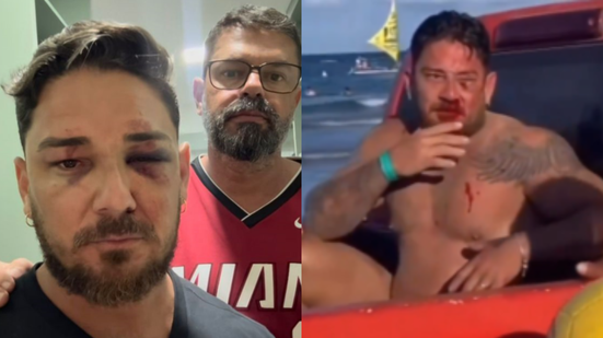 Reprodução