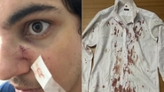 Reprodução/Redes sociais