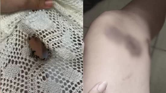 Reprodução/Redes Sociais