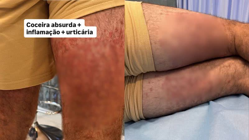 Reprodução / Redes Sociais