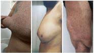 Montagem