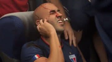 Reprodução/Redes Sociais