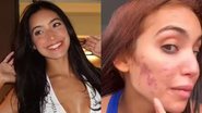 Reprodução Redes sociais