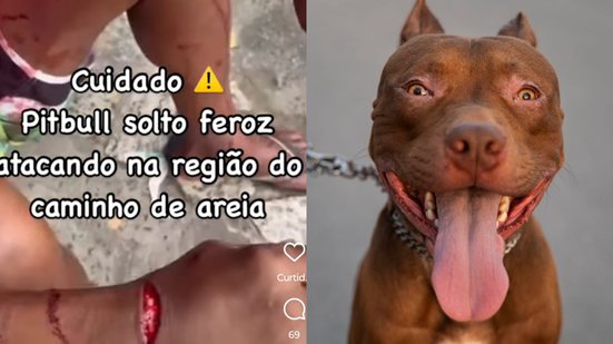 Reprodução Redes Sociais / Imagem ilustrativa de pitbull - Freepik