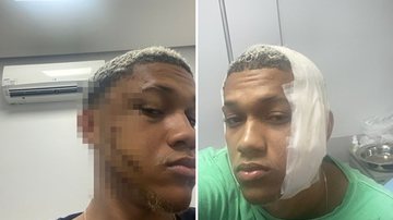 Montagem BNews/Reprodução/Leitor BNews