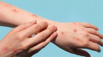 iStock