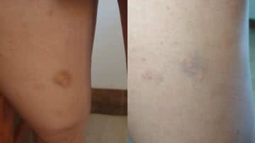 Reprodução/G1