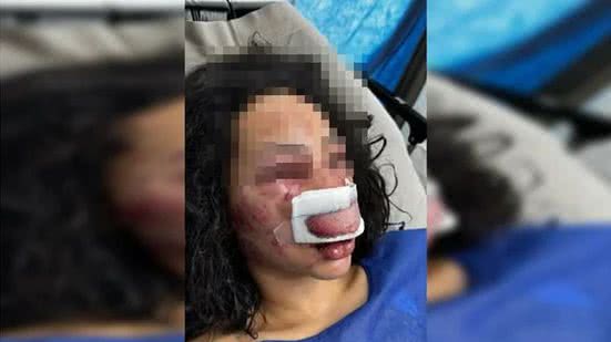 Reprodução / Redes Sociais