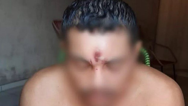 Homem levou tiro na testa e sobreviveu em Araguaína — Foto: Reprodução/Redes sociais