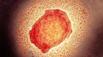SCIENCE PHOTO LIBRARY
