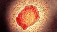 SCIENCE PHOTO LIBRARY
