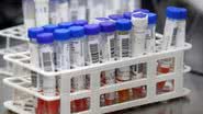 Divulgação/Sesab