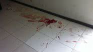 Imagem Cliente é baleado na porta do Banco do Brasil