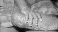 Imagem cortesia da Public Health