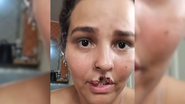 Imagem Marido manda matar chow-chow que arrancou lábio de mulher