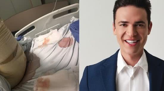 Reprodução