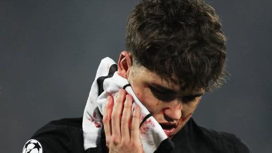 Imagem Zagueiro do Barcelona fica com rosto ensanguentado após levar pancada; imagens fortes