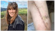 Imagem Mulher descobre que não tinha câncer após fazer 2 anos de tratamento
