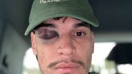 Reprodução/Redes sociais